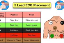 leads for ekg