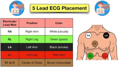 leads for ekg